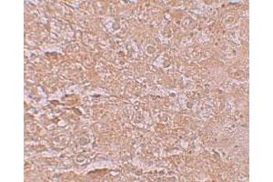 Immunohistochemical staining of mouse liver cells with SLC39A14 polyclonal antibody  at 2. (SLC39A14 Antikörper  (Internal Region))
