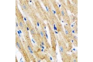 Immunohistochemical analysis of Tropomyosin 3 staining in mouse heart formalin fixed paraffin embedded tissue section.