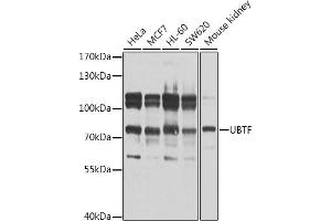 Western Blotting (WB) image for anti-Upstream Binding Transcription Factor, RNA Polymerase I (UBTF) (AA 200-440) antibody (ABIN6149866)