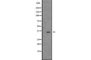 Western blot analysis of TRIO expression in HEK293 cells ,The lane on the left is treated with the antigen-specific peptide. (TRIO Antikörper  (Internal Region))