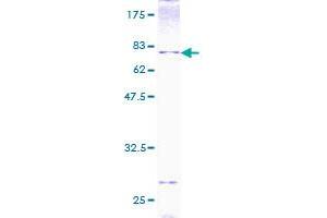 BMP7 Protein (AA 1-431) (GST tag)