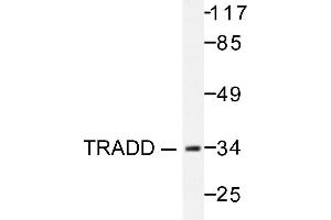 Image no. 1 for anti-TNFRSF1A-Associated Via Death Domain (TRADD) antibody (ABIN271966) (TRADD Antikörper)