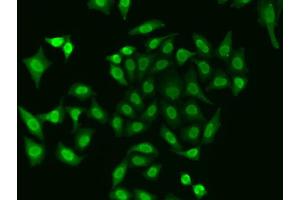 Immunofluorescence analysis of A549 cell using APEX1 antibody. (APEX1 Antikörper)