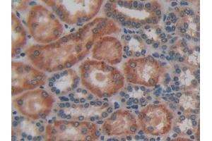 Immunohistochemistry (IHC) image for anti-Hemochromatosis Type 2 (Juvenile) (HFE2) (AA 41-386) antibody (ABIN7441934)