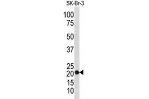 Western blot analysis of TAGLN antibody (N-term) in SK-Br-3 cell line lysates (35ug/lane). (Transgelin Antikörper  (N-Term))