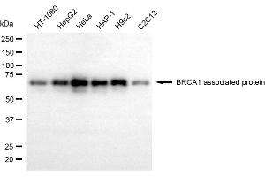 Western blotting analysis using BRCA1 associated protein antibody (ABIN7797784).