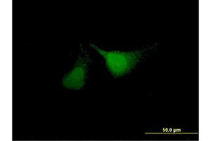 Immunofluorescence of monoclonal antibody to ANKRD37 on HeLa cell. (ANKRD37 Antikörper  (AA 1-158))