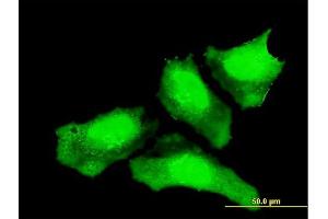 Immunofluorescence of monoclonal antibody to CTNNB1 on HeLa cell. (CTNNB1 Antikörper  (AA 682-781))