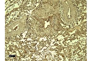 Immunohistochemistry (IHC) image for anti-Ionized Calcium-binding Adapter Molecule 1 (IBA1) (C-Term) antibody (ABIN184738)
