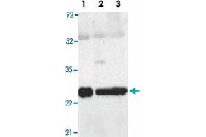 Western blot analysis of SEPT4 expression in human lung (lane 1), spleen (lane 2), and kidney (lane 3) tissue lysates with SEPT4 polyclonal antibody  at 2 ug /mL . (Septin 4 Antikörper  (N-Term))