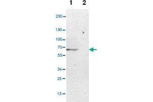 Western blot anyalysis of Lane 1: NIH-3T3 cell lysate (Mouse embryonic fibroblast cells), Lane 2: NBT-II cell lysate (Rat Wistar bladder tumour cells) with CPM polyclonal antibody .