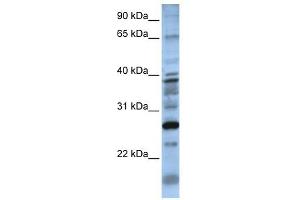 DOLPP1 antibody used at 1 ug/ml to detect target protein. (DOLPP1 Antikörper  (N-Term))