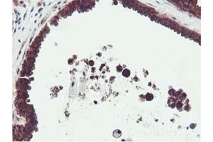 Immunohistochemical staining of paraffin-embedded Human breast tissue using anti-EPN2 mouse monoclonal antibody. (Epsin 2 Antikörper)
