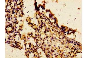 Immunohistochemistry of paraffin-embedded human lung tissue using ABIN7156829 at dilution of 1:100 (IL18R1 Antikörper  (AA 22-128))