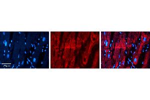 Immunohistochemistry (IHC) image for anti-Prohibitin 2 (PHB2) (C-Term) antibody (ABIN2783329)