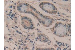 Immunohistochemistry (IHC) image for anti-Mechanistic Target of Rapamycin (serine/threonine Kinase) (mTOR) (AA 2226-2488) antibody (ABIN7440680)
