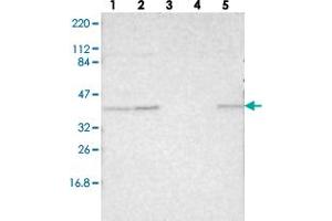 Western blot analysis of Lane 1: RT-4, Lane 2: U-251 MG, Lane 3: Human Plasma, Lane 4: Liver, Lane 5: Tonsil with MAFB polyclonal antibody  at 1:250-1:500 dilution. (MAFB Antikörper)