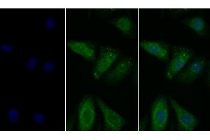 Detection of PDL1 in Human Hela cell using Polyclonal Antibody to Programmed Cell Death Protein 1 Ligand 1 (PDL1) (PD-L1 Antikörper  (AA 24-234))