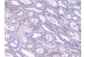 DAB staining on IHC-P; Samples: Human Kidney Tissue (Acylglycerol Kinase Antikörper  (AA 15-300))