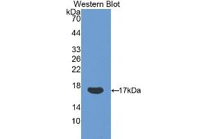 Western blot analysis of the recombinant protein. (Ribonuclease A8 Antikörper  (AA 19-154))