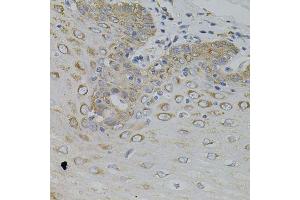 Immunohistochemistry of paraffin-embedded human esophagus using IRF1 antibody. (IRF1 Antikörper)