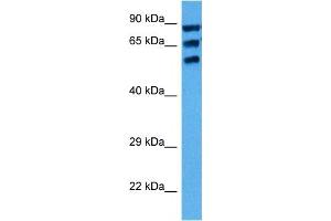 Host:  Mouse  Target Name:  CYP1A1  Sample Tissue:  Mouse Testis  Antibody Dilution:  1ug/ml (CYP1A1 Antikörper  (Middle Region))