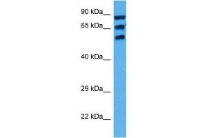 Western Blotting (WB) image for anti-Cytochrome P450, Family 1, Subfamily A, Polypeptide 1 (CYP1A1) (Middle Region) antibody (ABIN2776793)