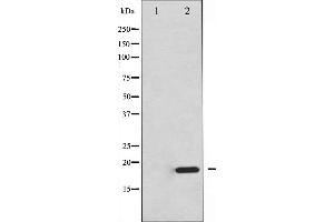 Western blot analysis of 4E-BP1 expression in EGF treated MDA-MB-435 whole cell lysates,The lane on the left is treated with the antigen-specific peptide. (eIF4EBP1 Antikörper  (Internal Region))