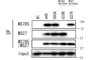Detection of SOD1 mutants by immunoprecipitation assay SOD1 wild type or mutants-expressing HEK293 cells were lysed by 1 % Triton X100/TBS buffer.