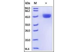 SDS-PAGE (SDS) image for Renin (REN) (AA 22-402) protein (His tag) (ABIN2181693)