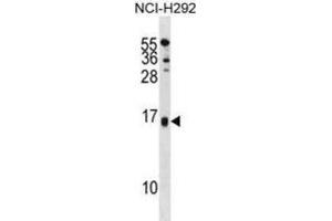 Western Blotting (WB) image for anti-Selenoprotein M (SELM) antibody (ABIN3001336) (SELM Antikörper)