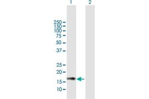 Western Blot analysis of IL15 expression in transfected 293T cell line by IL15 MaxPab polyclonal antibody.