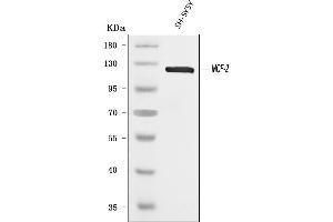 Western blot analysis of DBL using anti-DBL antibody (ABIN7601702).