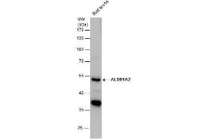 WB Image ALDH1A2 antibody detects ALDH1A2 protein by western blot analysis. (ALDH1A2 Antikörper)