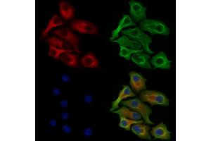 Phospho-EPRS (Ser886) Antibody staining Hela cells(heat shock treatment) by IF/ICC. (EPRS Antikörper  (pSer886))