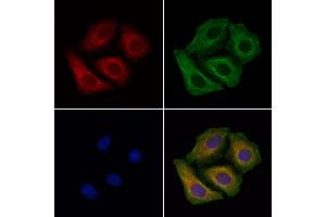 ABIN6265800 and ABIN6266909 staining Hela cells by IF/ICC.
