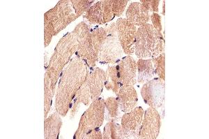 Immunohistochemical analysis of paraffin-embedded H. (CARD6 Antikörper  (AA 755-787))