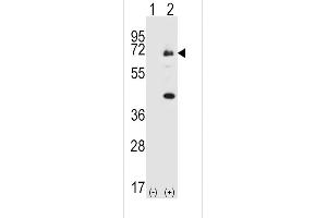 Western Blotting (WB) image for anti-Spleen tyrosine Kinase (SYK) (AA 387-417), (C-Term) antibody (ABIN6243735)