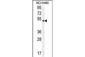 Western blot analysis in NCI-H460 cell line lysates (35ug/lane). (DENND1B Antikörper  (N-Term))