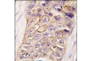 Image no. 2 for anti-Phosphatidylinositol-4-Phosphate 3-Kinase, Catalytic Subunit Type 2 beta (PIK3C2B) (N-Term) antibody (ABIN360437) (PIK3C2B Antikörper  (N-Term))