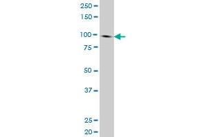 NBN monoclonal antibody (M01), clone 3E4 Western Blot analysis of NBN expression in HL-60 . (Nibrin Antikörper  (AA 645-754))