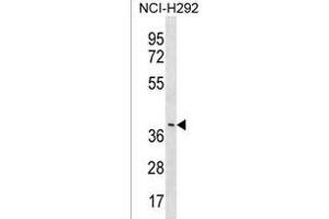Y Antibody (C-term) (ABIN1537198 and ABIN2838091) western blot analysis in NCI- cell line lysates (35 μg/lane). (LRRC74B Antikörper  (C-Term))