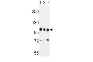 Western Blotting (WB) image for anti-Enhancer of Zeste Homolog 2 (EZH2) antibody (ABIN3001535) (EZH2 Antikörper)