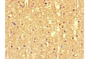 Immunohistochemistry of paraffin-embedded human brain tissue using ABIN7146400 at dilution of 1:100 (SS18L1 Antikörper  (AA 47-396))