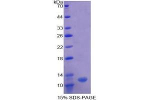SDS-PAGE analysis of Human OAS1 Protein. (OAS1 Protein)