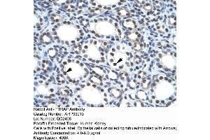 Human kidney (TDP2 Antikörper  (Middle Region))
