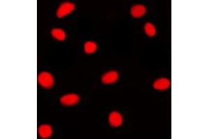 Immunofluorescent analysis of GADD153 staining in Jurkat cells. (DDIT3 Antikörper  (N-Term))
