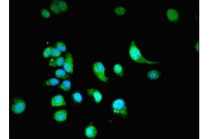Immunofluorescent analysis of MCF-7 cells using ABIN7161936 at dilution of 1:100 and Alexa Fluor 488-congugated AffiniPure Goat Anti-Rabbit IgG(H+L) (NXF3 Antikörper  (AA 1-531))