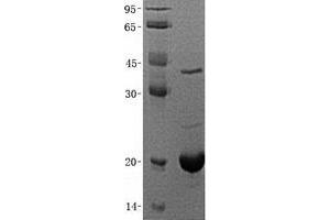 Western Blotting (WB) image for Fibroblast Growth Factor 12 (FGF12) (Transcript Variant 2) protein (His tag) (ABIN2721057)
