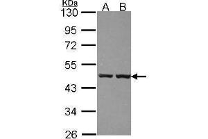 WB Image Sample (30 ug of whole cell lysate) A: 293T B: A431 , 10% SDS PAGE antibody diluted at 1:1000 (ZNF396 Antikörper)